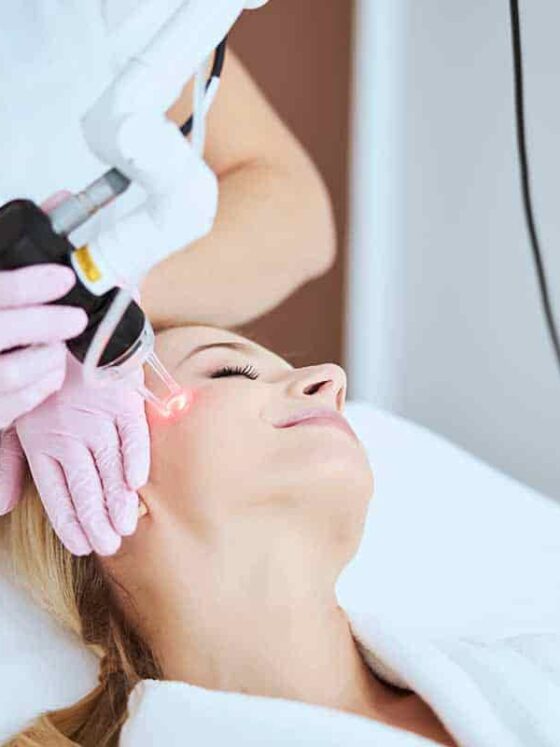 Dos And Don’ts After A Facial Laser Treatment