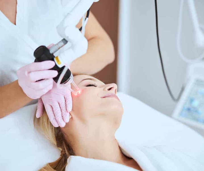 Dos And Don’ts After A Facial Laser Treatment