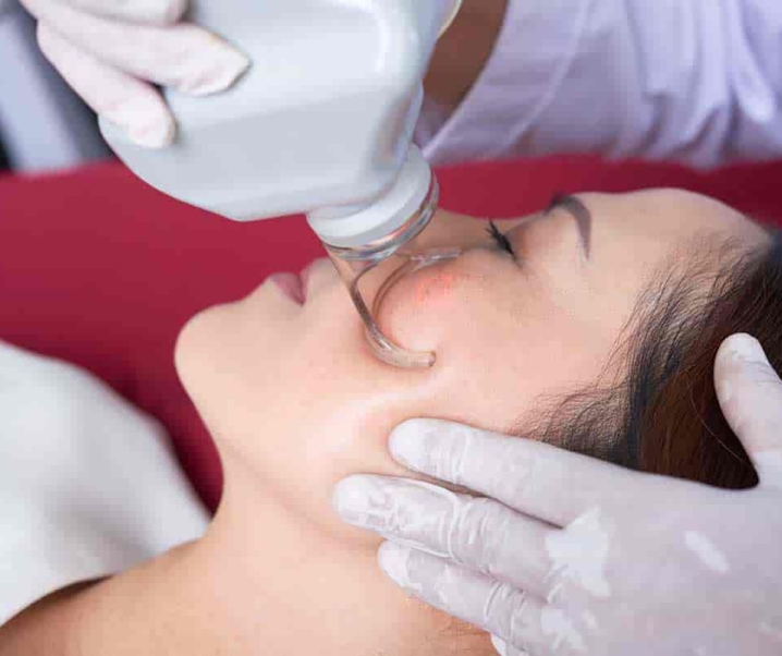 Aesthetic Laser 101: Cost, Uses and More